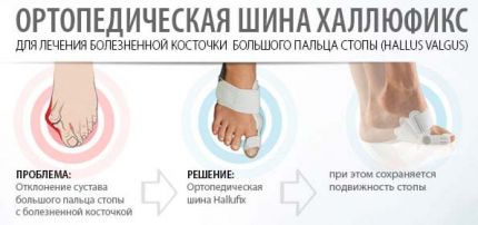 hallufix